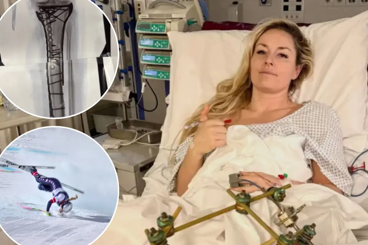 تقدم Lindsey Vonn تحديثًا مروعًا بعد الحادث الأولمبي: "Bionic for real now"
