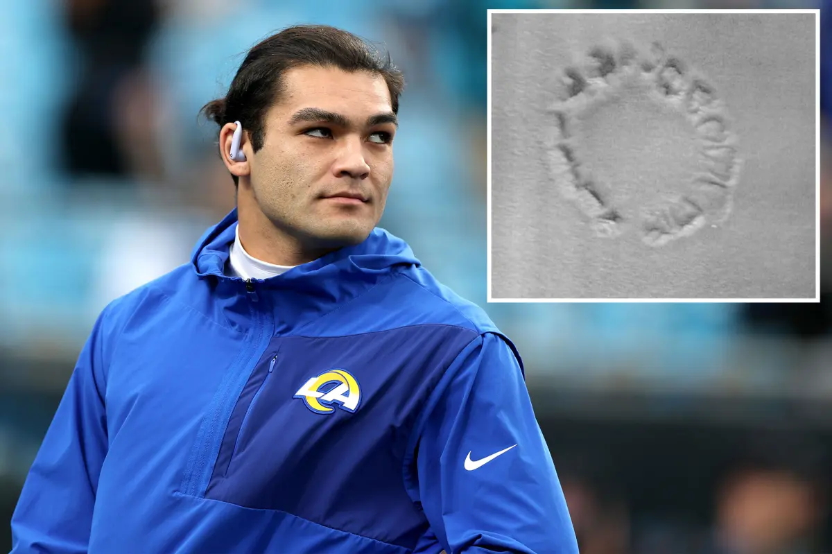 يقول بوكا ناكوا إن متهم العض كان مخمورا أثناء الحادث المزعوم